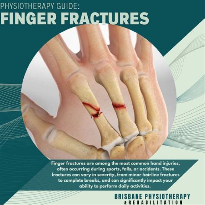Brodie Moss Finger Bite: Decoding the Buzz Around a Curious Search