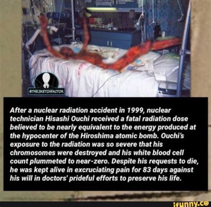 Hisashi Ouchi: A Look at an Unprecedented Struggle with Radiation